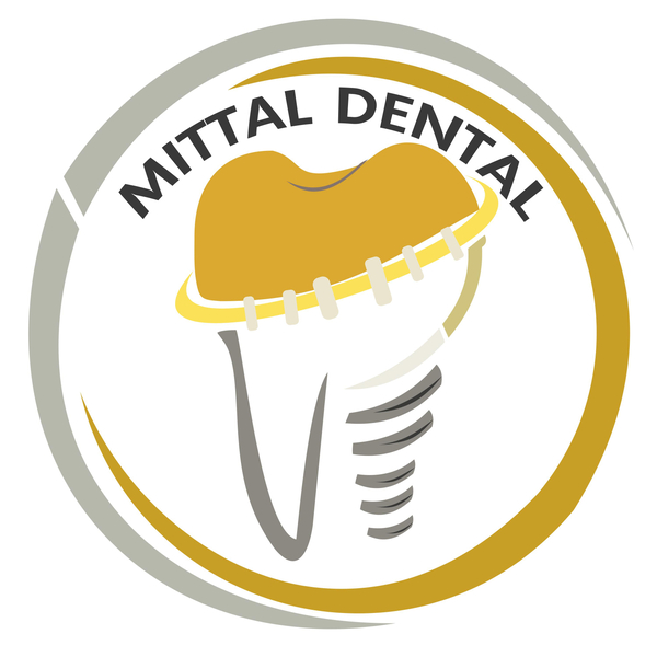 Cover photo of Mittal Dental Care and Implant Centre | Best Dental Clinic in Mohali
